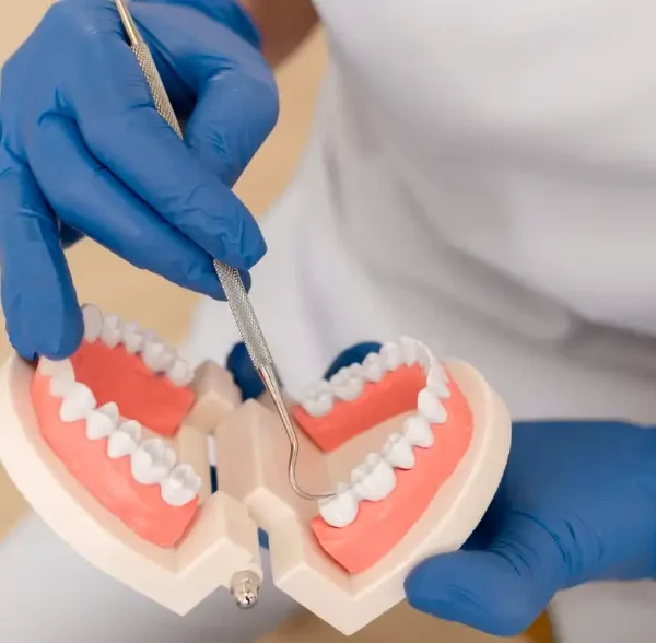 Full Arch Dental Implants: Everything You Need to Know Before Making a Decision